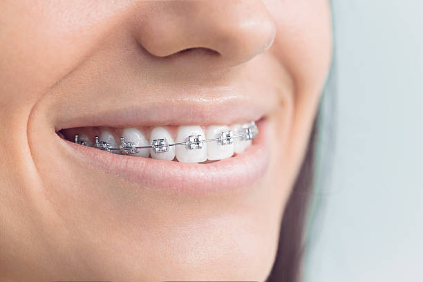 Best Root Canal Treatment  in Medulla, FL